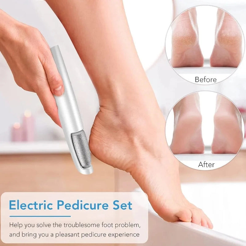 PediPulse™ Gentle Callus Relief for Sensitive Feet, Walk Freely Again!